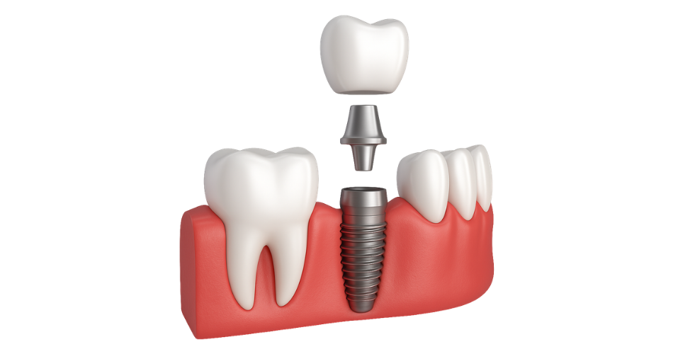 hjemmeside frederikssund tandcenter (10)