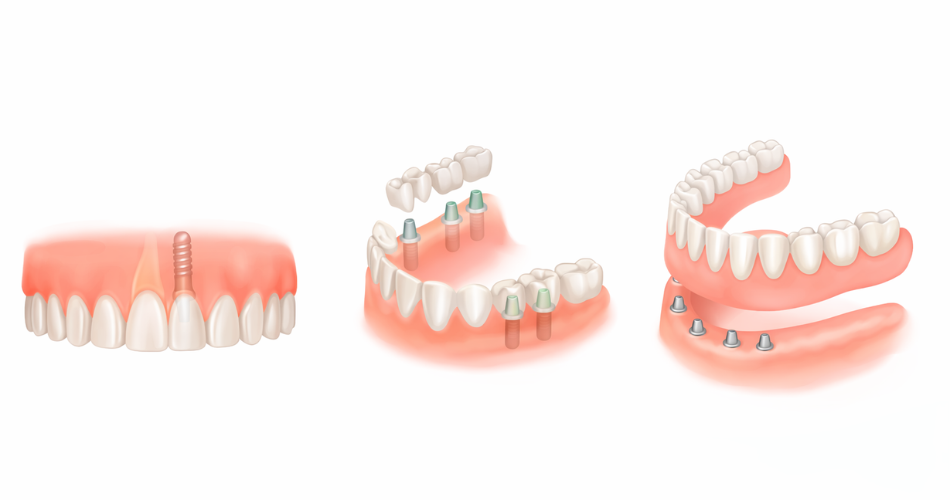 hjemmeside frederikssund tandcenter (11)