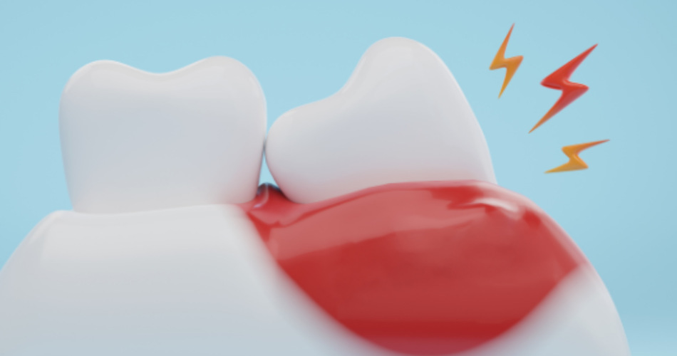 hjemmeside frederikssund tandcenter (2)